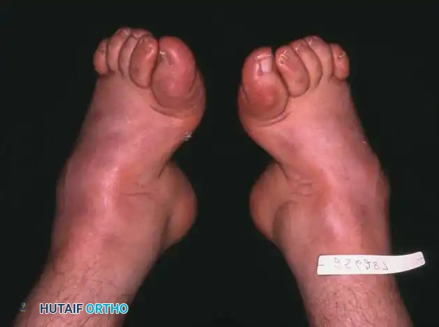 Hutaifortho's Orthopaedic Diagram