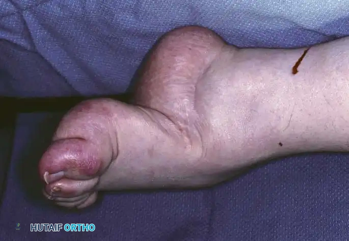 Hutaifortho's Orthopaedic Diagram