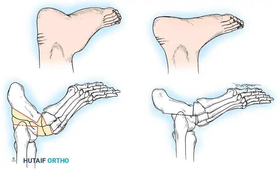 Hutaifortho's Orthopaedic Diagram