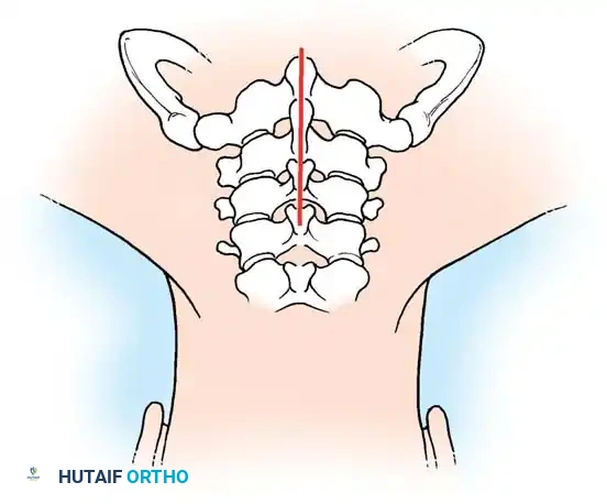 Hutaifortho's Orthopaedic Diagram