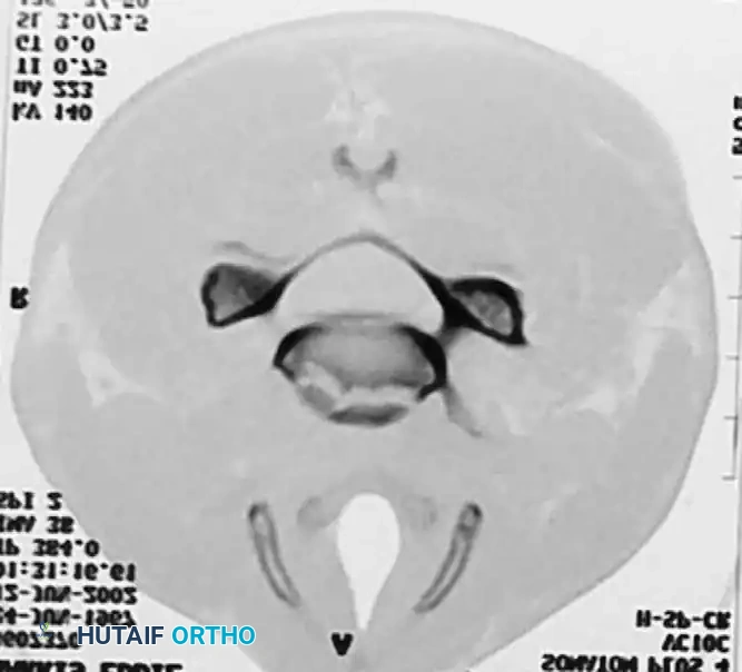 Hutaifortho's Orthopaedic Diagram