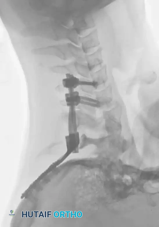 Hutaifortho's Orthopaedic Diagram