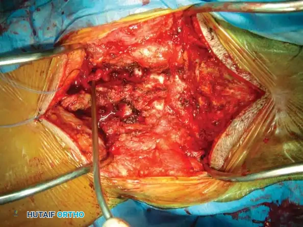 Hutaifortho's Orthopaedic Diagram