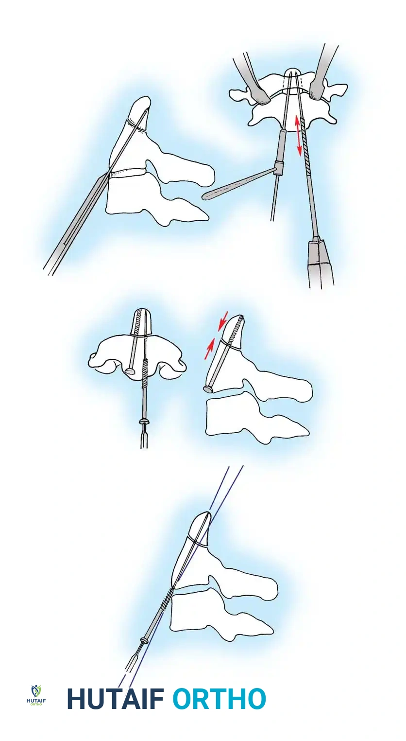 Hutaifortho's Orthopaedic Diagram