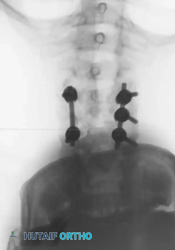Hutaifortho's Orthopaedic Diagram