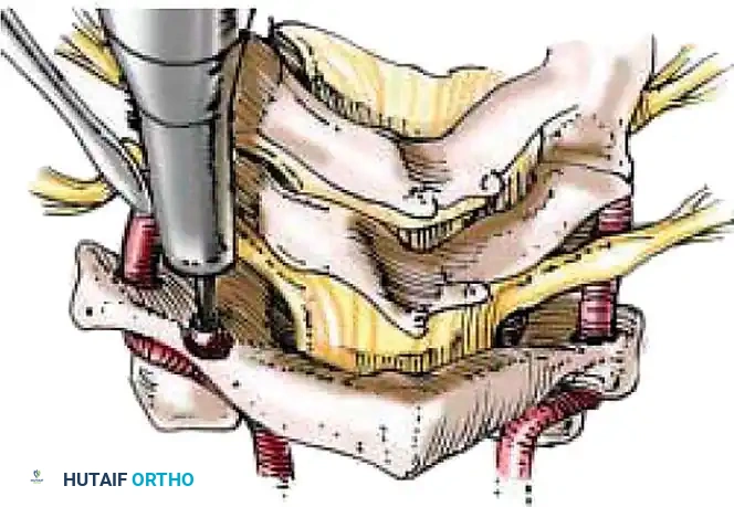 Hutaifortho's Orthopaedic Diagram