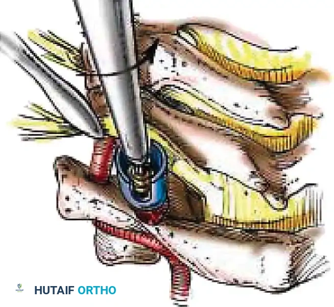 Hutaifortho's Orthopaedic Diagram