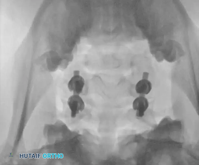 Hutaifortho's Orthopaedic Diagram
