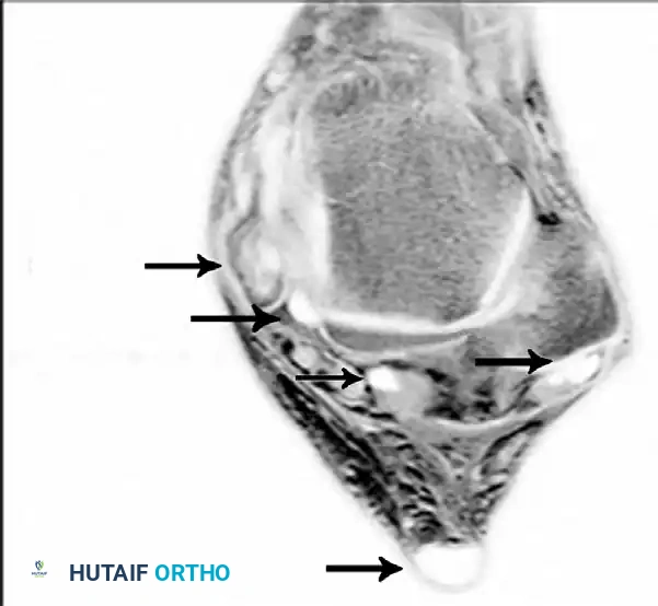 Hutaifortho's Orthopaedic Diagram