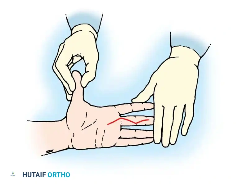 Anesthesia in Hand and Upper Extremity Surgery: A Masterclass