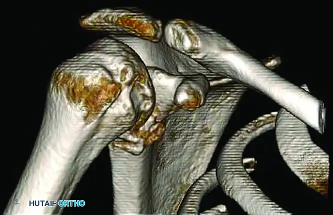 CLASSIFICATION Surgical Diagram