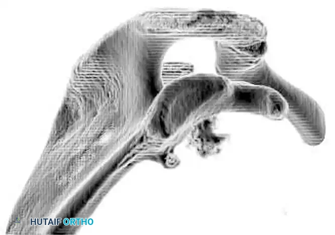 CLASSIFICATION Surgical Diagram