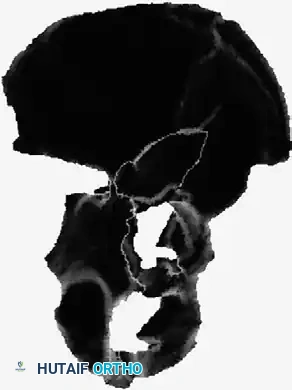 Hutaifortho's Orthopaedic Diagram