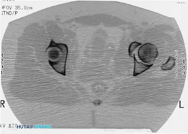 Hutaifortho's Orthopaedic Diagram