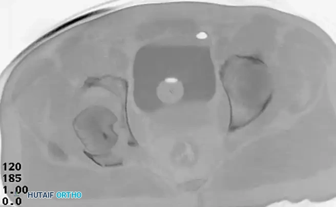 Hutaifortho's Orthopaedic Diagram
