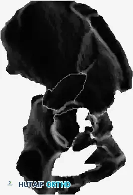 Hutaifortho's Orthopaedic Diagram