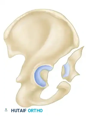 Hutaifortho's Orthopaedic Diagram