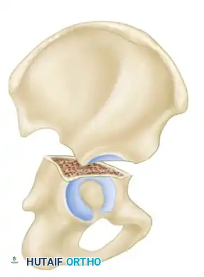 Hutaifortho's Orthopaedic Diagram