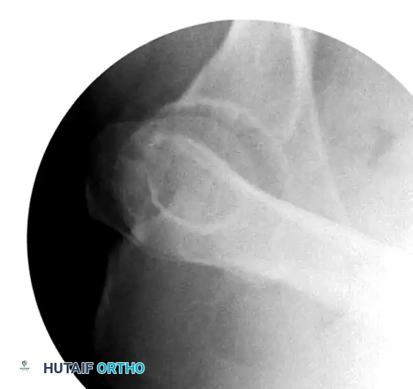 Hutaifortho's Orthopaedic Diagram