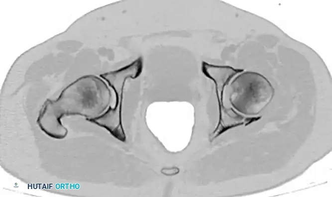 CLASSIFICATION Surgical Diagram