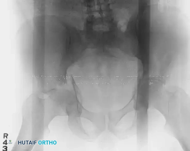 Hutaifortho's Orthopaedic Diagram