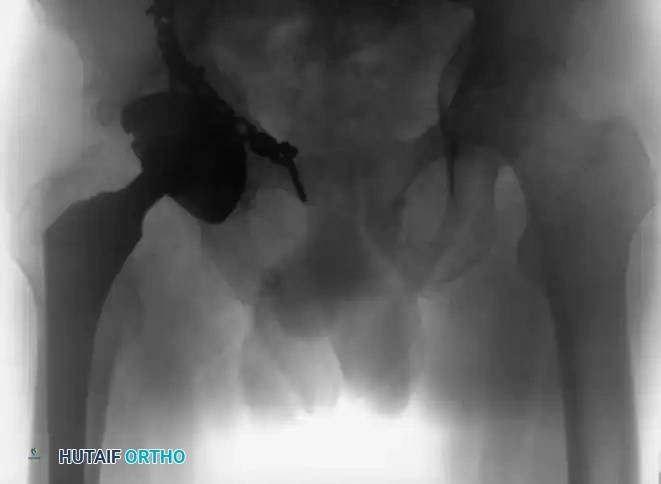 CLASSIFICATION Surgical Diagram