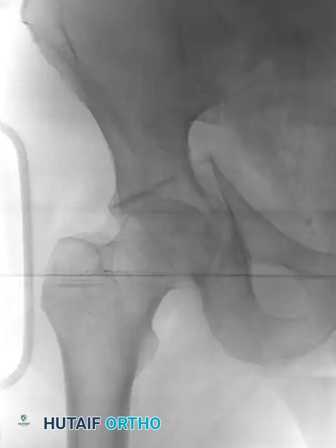 Hutaifortho's Orthopaedic Diagram