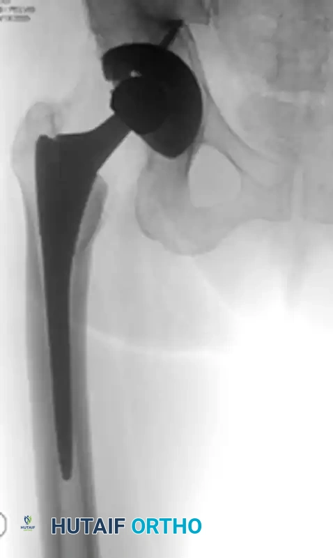 Hutaifortho's Orthopaedic Diagram