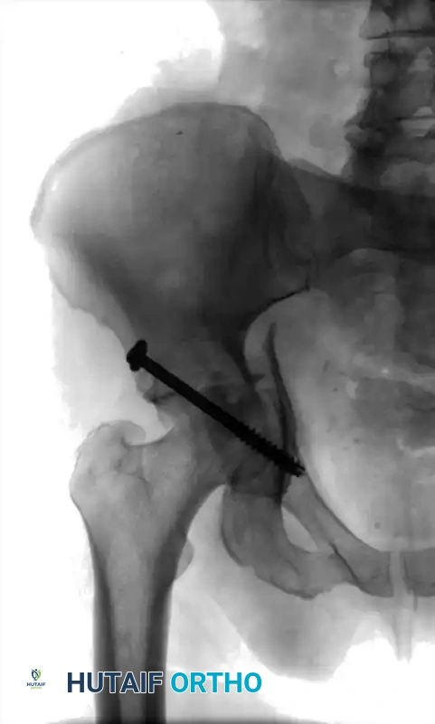 Hutaifortho's Orthopaedic Diagram
