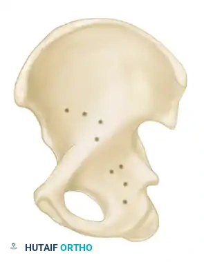 Hutaifortho's Orthopaedic Diagram