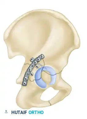 Hutaifortho's Orthopaedic Diagram