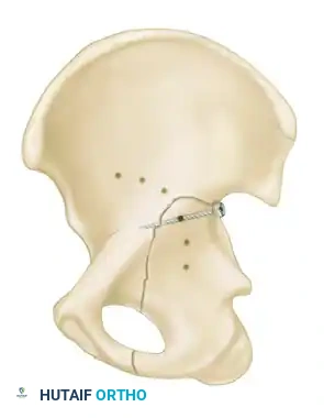 Hutaifortho's Orthopaedic Diagram