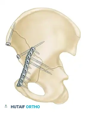 Hutaifortho's Orthopaedic Diagram