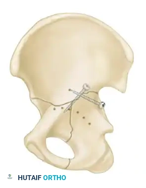 Hutaifortho's Orthopaedic Diagram