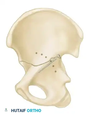 Hutaifortho's Orthopaedic Diagram