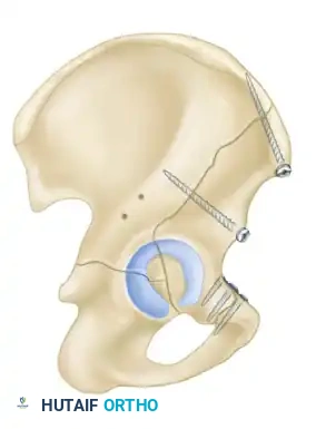 Hutaifortho's Orthopaedic Diagram