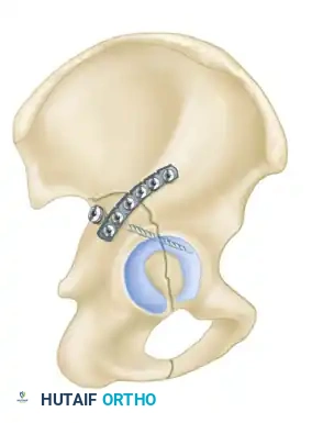 Hutaifortho's Orthopaedic Diagram