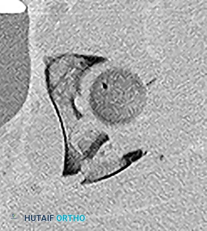 Hutaifortho's Orthopaedic Diagram