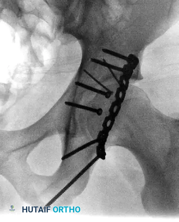 Hutaifortho's Orthopaedic Diagram