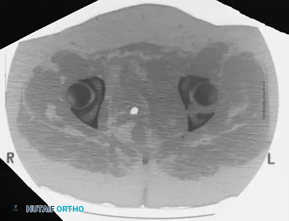 Hutaifortho's Orthopaedic Diagram