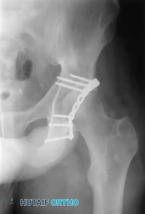 Hutaifortho's Orthopaedic Diagram