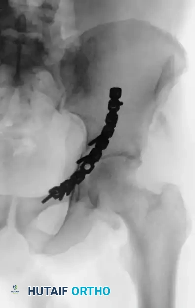 Hutaifortho's Orthopaedic Diagram