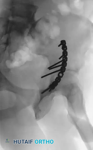 CLASSIFICATION Surgical Diagram