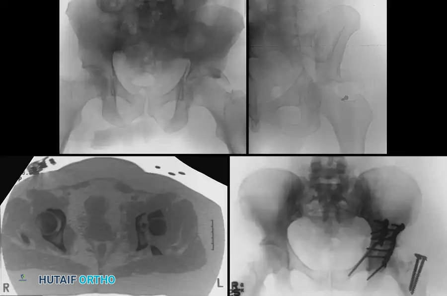 Hutaifortho's Orthopaedic Diagram