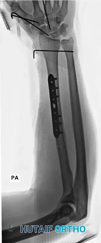 CLASSIFICATION Surgical Diagram