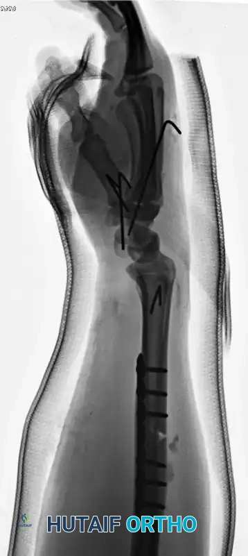 CLASSIFICATION Surgical Diagram