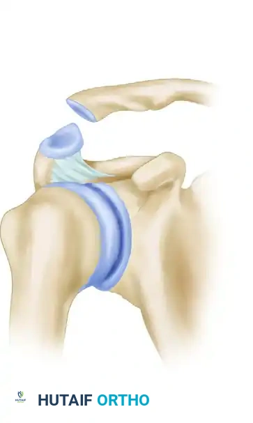 CLINICAL FINDINGS Surgical Diagram