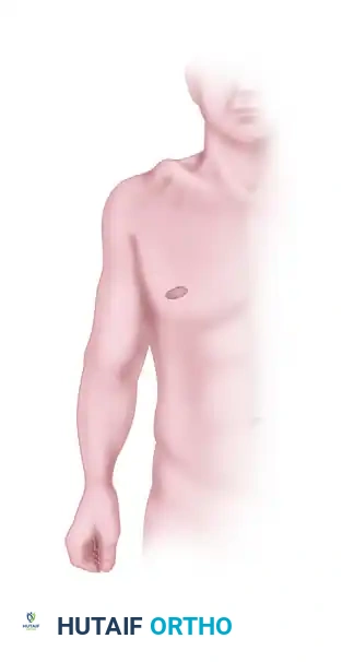 CLINICAL FINDINGS Surgical Diagram