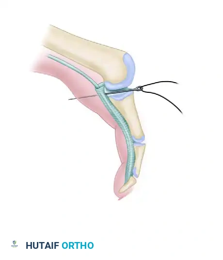 CLINICAL FINDINGS Surgical Diagram