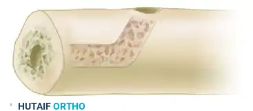 Combination Tenodesis of the Flexor Carpi Ulnaris and Extensor Carpi Ulnaris: A Comprehensive Surgical Guide